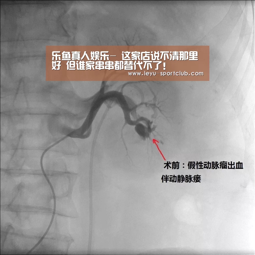 乐鱼电竞直播